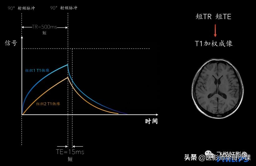 飞利浦磁共振图像操作,飞利浦磁共振成像序列及应用