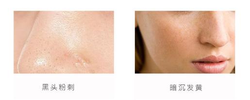 总算为国货争了口气，98.21%除螨率的洗面奶，张馨予也爱用