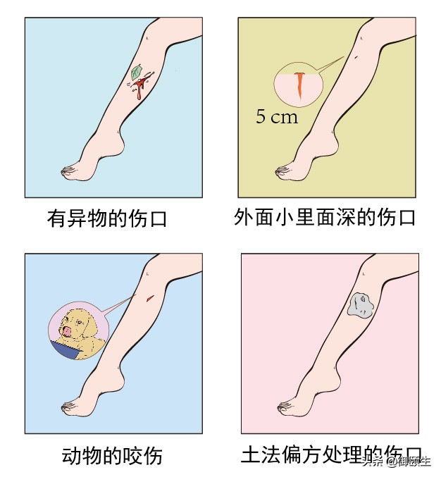 春假出游，磕碰受伤需打破伤风吗？四种情况最易感染，危及生命
