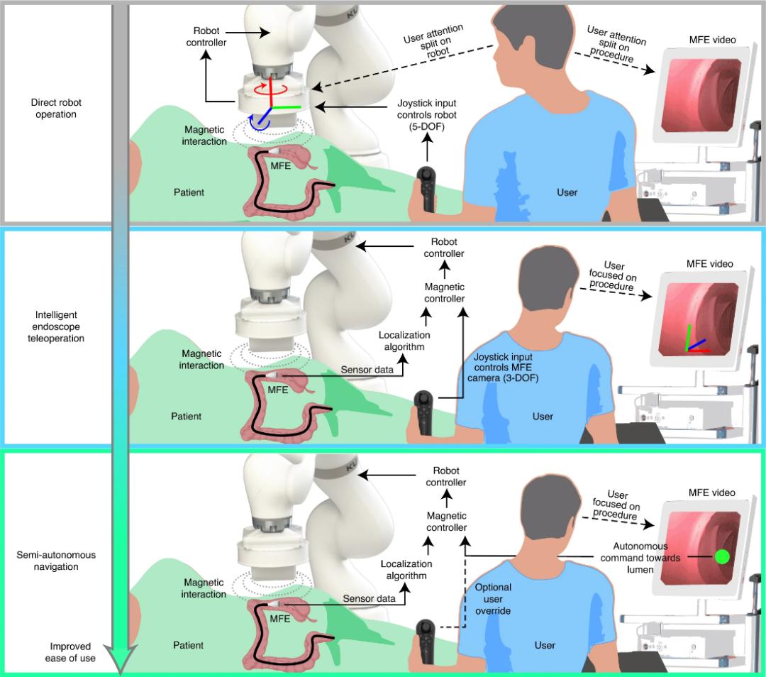 无痛电子结肠镜,结肠镜检查仪器