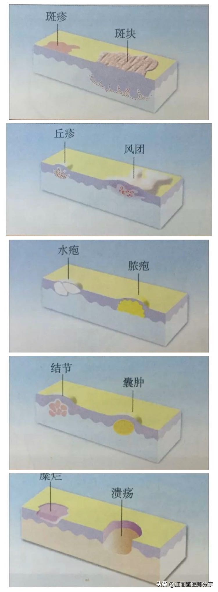 皮肤过敏用999皮炎平会好吗,碰到皮肤问题常规处理错误