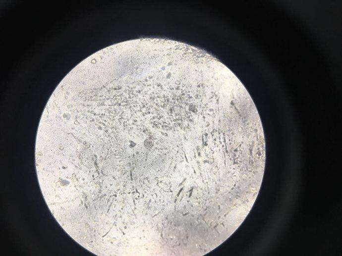 球虫药不能和什么药一起用,替米考星可以和球虫药一起用吗