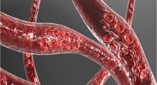 夏天怎样会容易使人的血管炸裂,夏天如何防止心脑血管崩溃