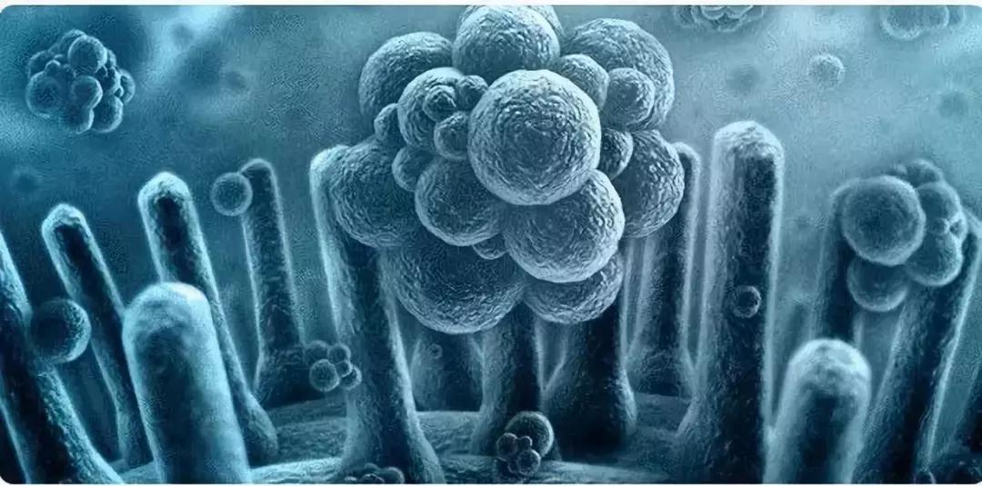 23岁女子患外阴癌癌前病变,23岁外阴癌变化