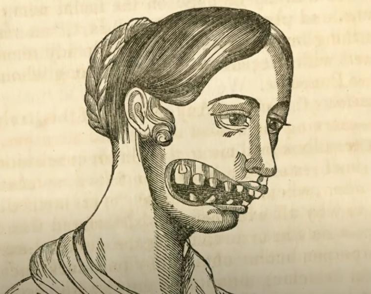 牙齿烂光，脸长巨瘤，骨头还会发光，被美国资本家逼向绝路的女工