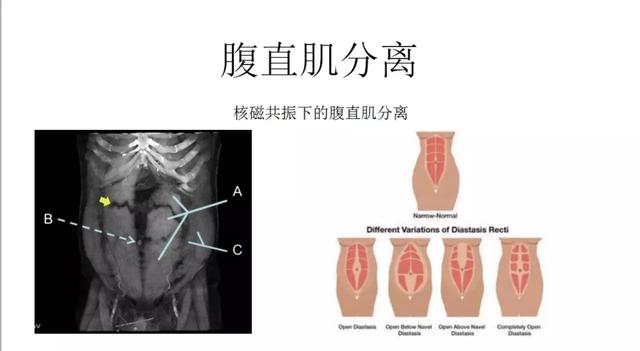 产后恢复少女感,有关产后恢复的图片