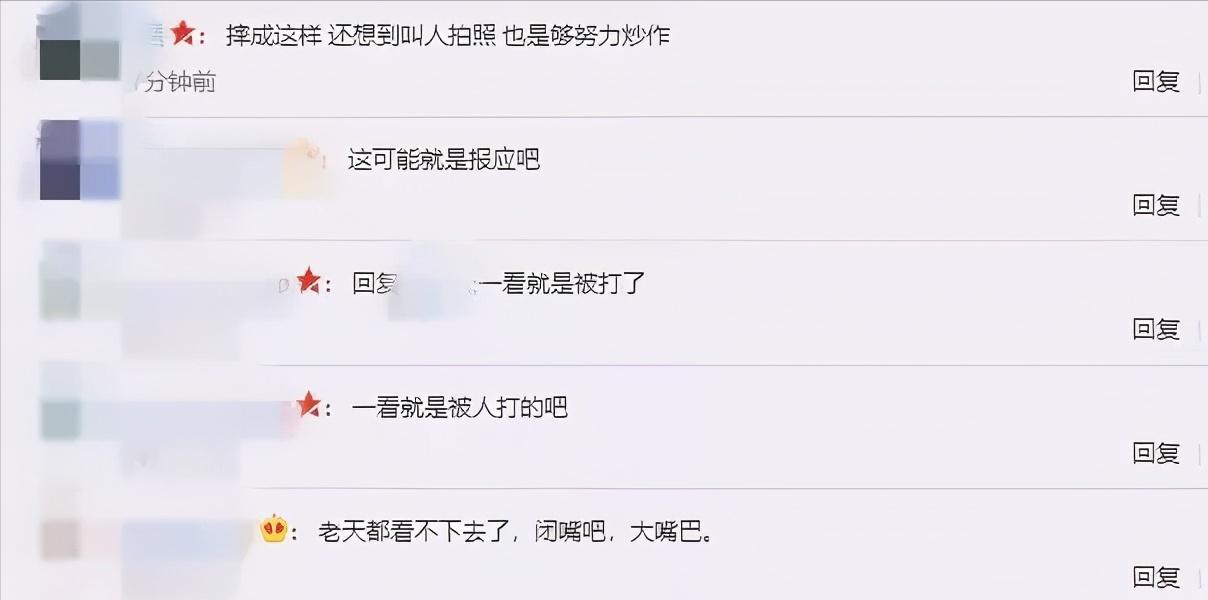 范玮琪不被喜欢的原因,范玮琪说没有伤害过任何人