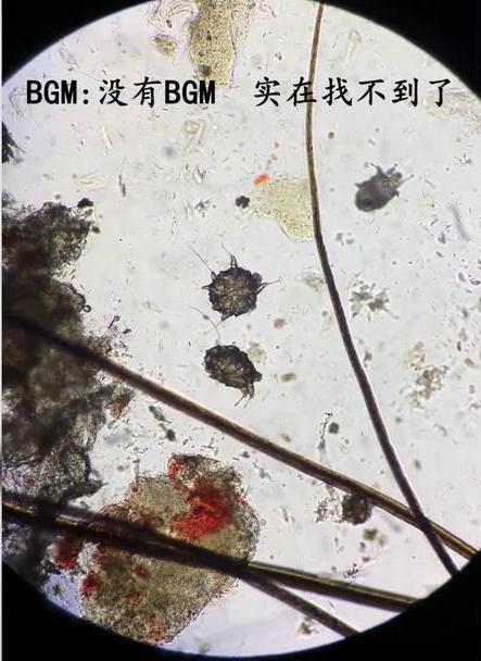 有没有可以祛除螨虫的产品,有没有什么除螨虫的用品