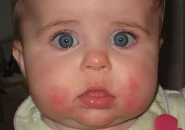 宝宝非长牙期流口水是什么原因,宝宝长牙期流口水流得严重怎么办