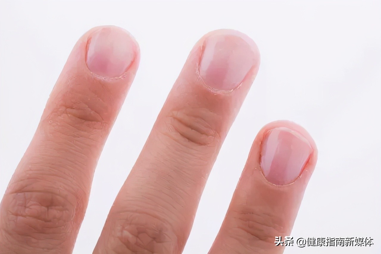 如何治疗灰指甲中药偏方,如何治疗灰指甲