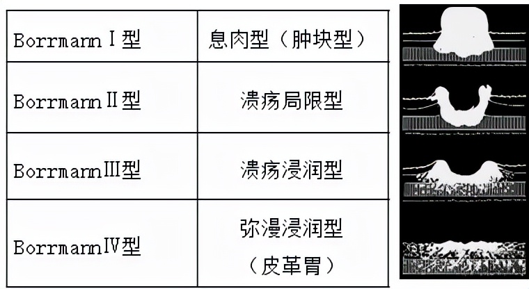 我不是药神,我不是财迷!若患胃癌,这些靶向药你有能力负担吗?