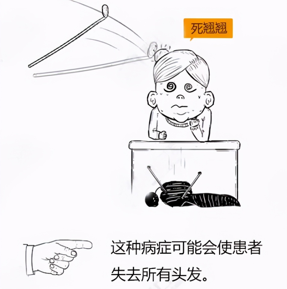 美女主持人突然上热搜，网友纷纷晒同款！脱发原来是毛囊“休息”了