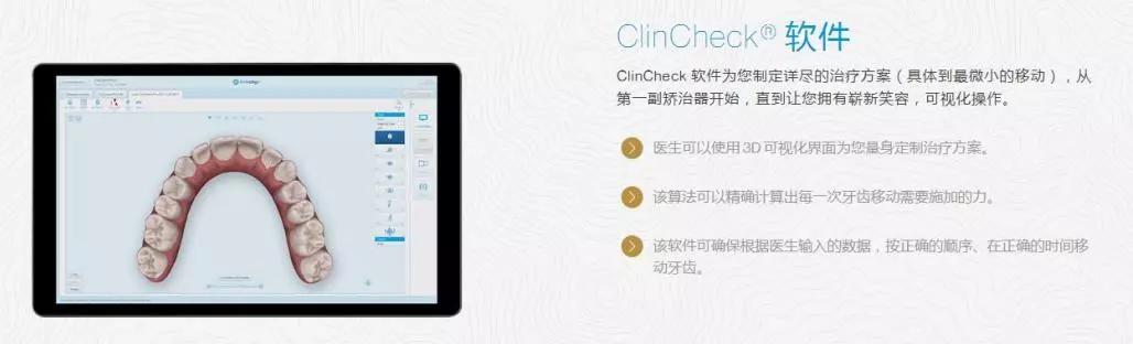 隐形牙套怎么让牙齿变好看,怎么弄隐形牙套