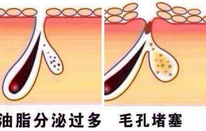 头皮痒长包有点疼怎么办,头皮起小包按压疼痛