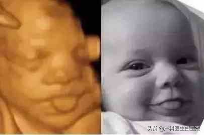 做四维彩超能看到胎儿图片吗,四维彩超图片就是胎儿的样子吗