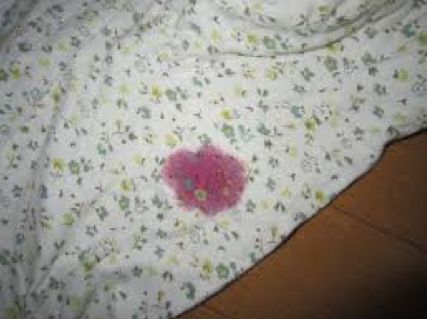 日本口腔健康现状,口腔医疗行业深度分析