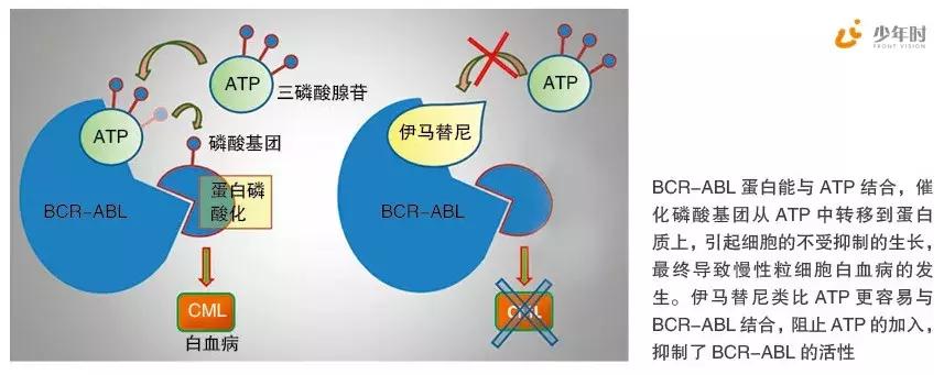 费城染色体形成原因,费城染色体会有什么影响