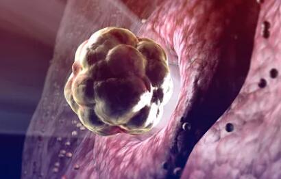 试管婴儿打夜针常识,试管婴儿常识2012