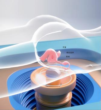 子宫肌瘤合并腺肌症手术后复发率,腺肌瘤复发