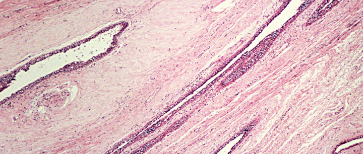 螺纹的基本知识讲解非常详细,常用螺纹标准一览表