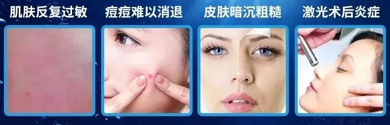 修复面膜医用面膜排行榜第一名,仁和祛痘面膜是正规医用面膜吗