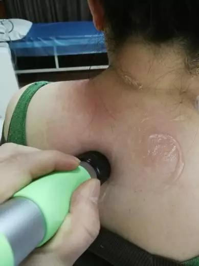 冲击疗法详细介绍,冲击疗法属于什么疗法