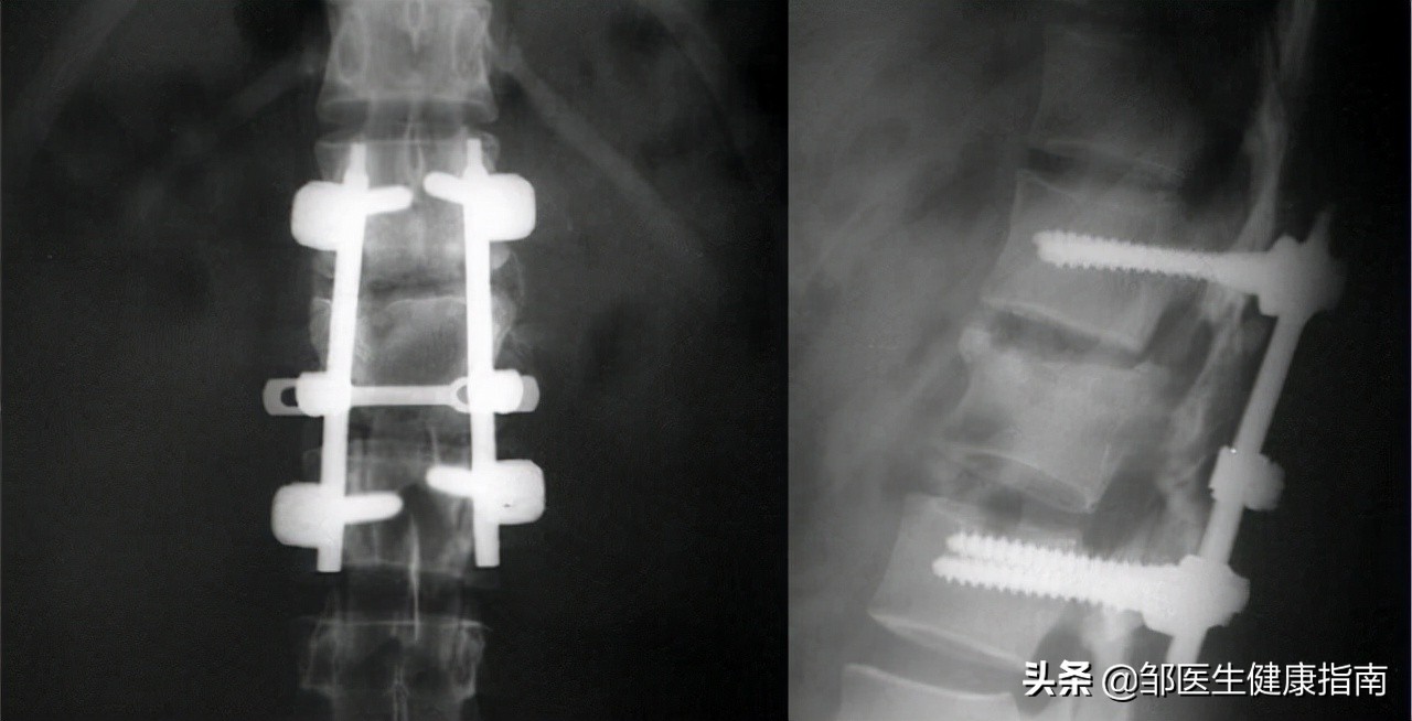 45岁绝经是不是太早了有什么不好,绝经太早或太晚都不是好事