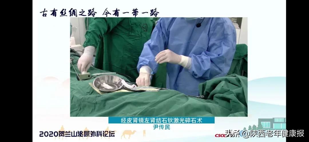 大兴医院泌尿科尹传民,尹传民大兴医院泌尿外科