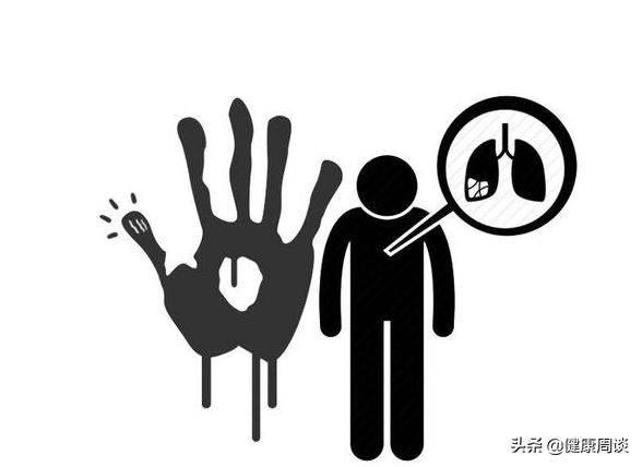 手指变粗肺癌前兆,手指关节变粗是肺癌吗