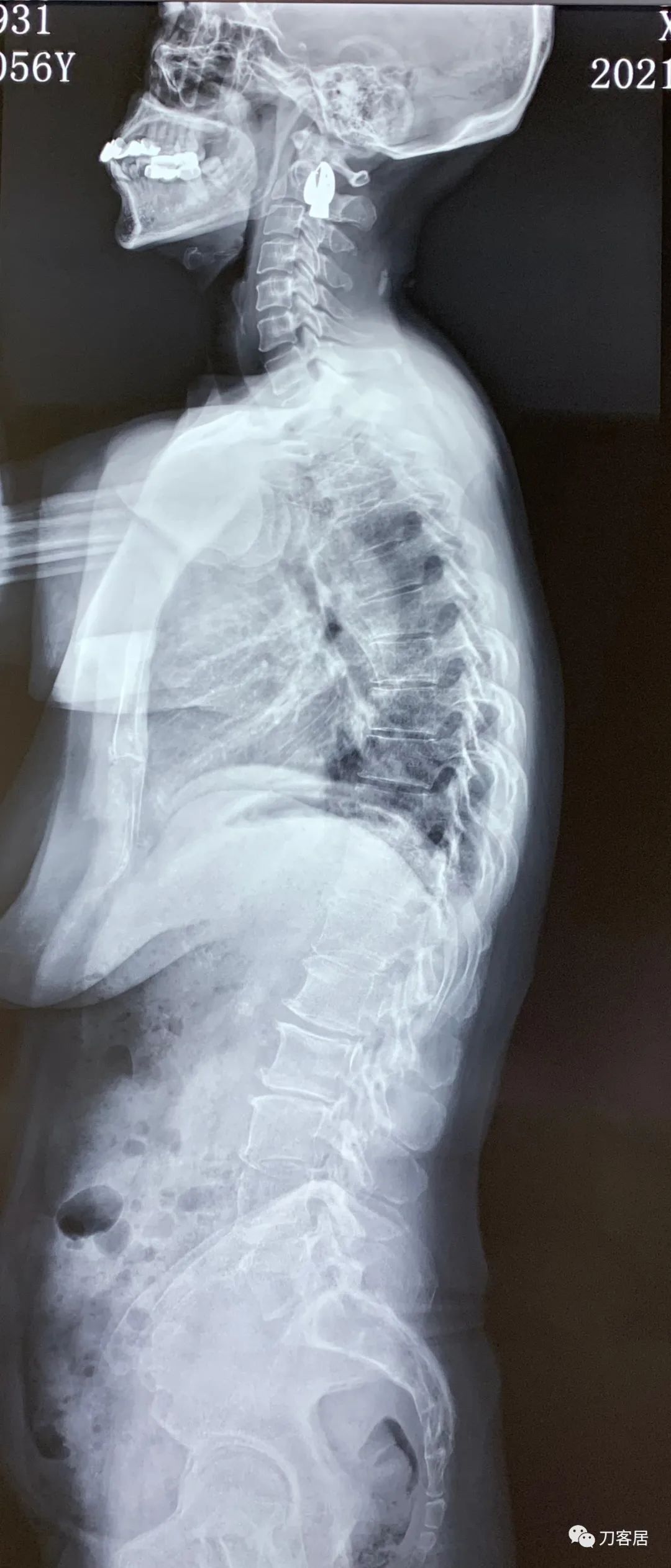 我的门诊病历,我的门诊