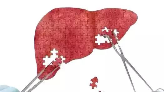 方药中老先生：诊断肝癌后，存活13年未复发，中医如何有效治疗肝癌