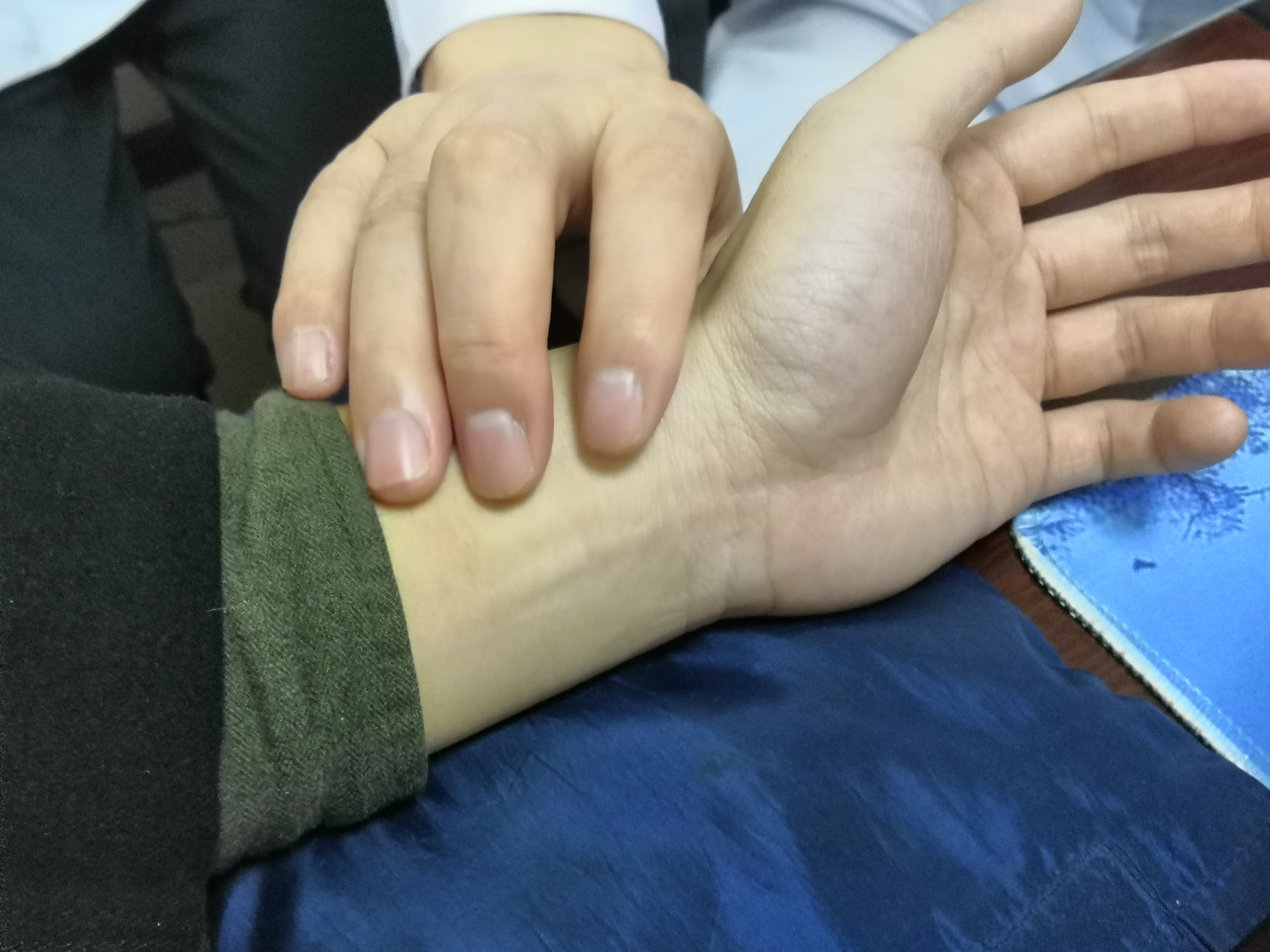 3个方法轻松解决前列腺疾病,如何快速有效的治疗前列腺疾病