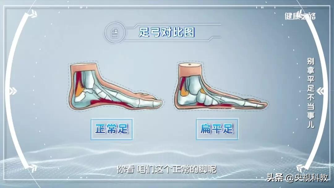 腰疼引起腿和脚麻是怎么回事,经常腰痛原来是脚的问题