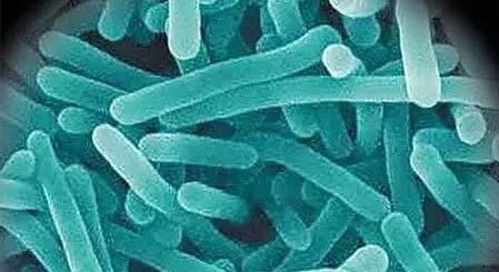 冰箱隐形杀手,冰箱里暗藏隐形杀手