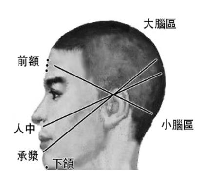 由急救掐人中谈起（作者：杜建华）