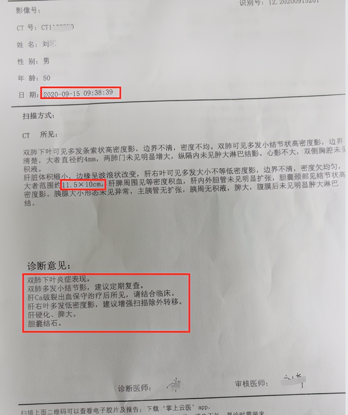 肝癌门静脉癌栓晚期大出血原因,肝癌肿瘤破裂出血手术成功率