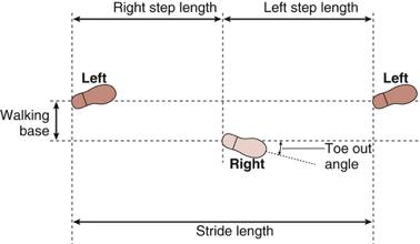 每天都进行走路运动，如果发现姿势异常，要考虑肌肉和神经疾病