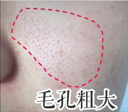 在空调屋里皮肤干燥、瘙痒、泛红，我来帮你解决