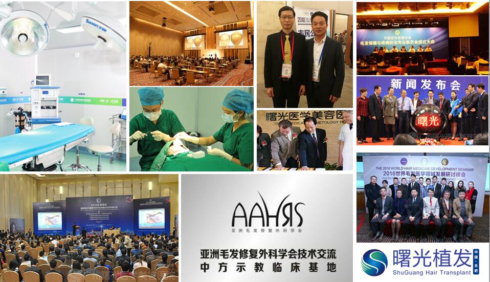 合肥脱发植发,合肥曙光植发