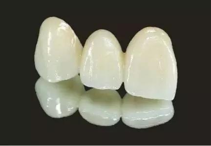 13岁牙齿根管治疗后需要做牙冠吗,根管治疗医生没给我做牙冠