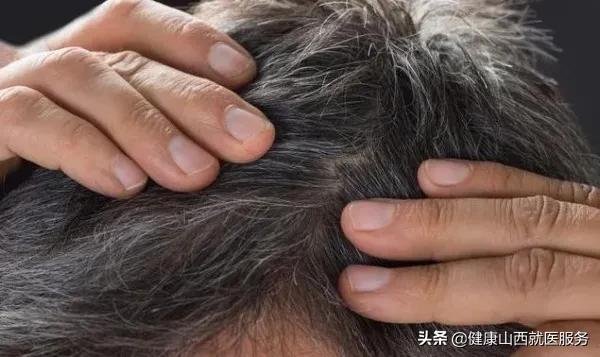 为什么有人年纪轻轻就有白发,为什么年纪轻白发增多