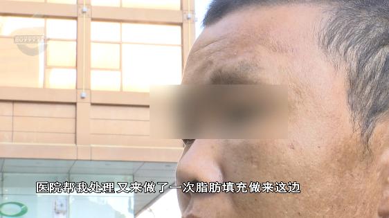 张嘴会响左右不对称！30岁小伙花三万“去颧骨”失败找院方协商还想再做手术