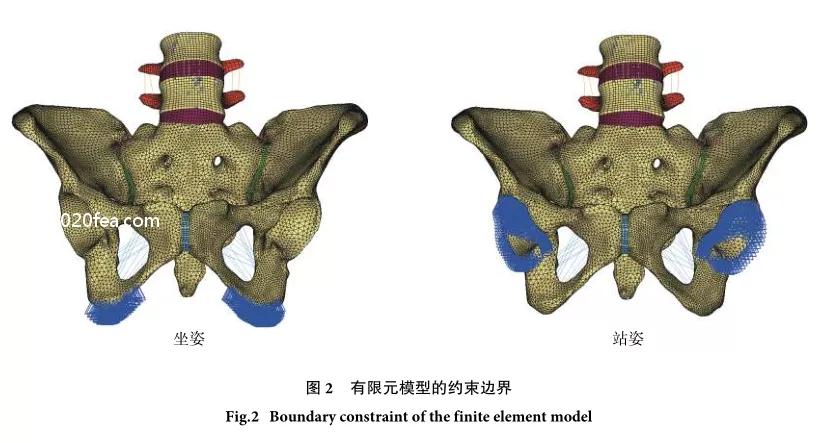 骶骨骨折没内固定能评几级,u型钉67公分单价