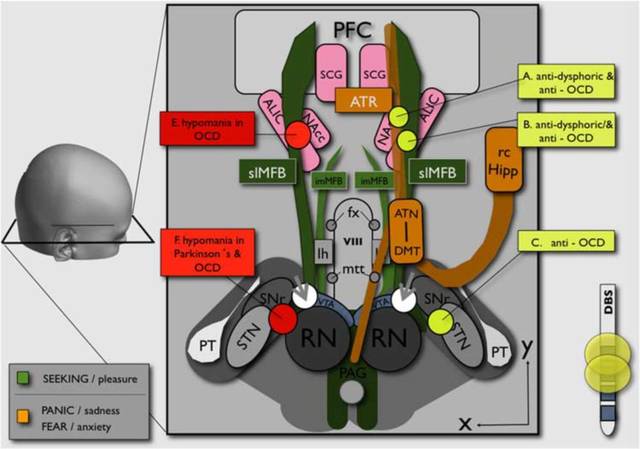 强迫症最好的治疗方法,小柴胡汤治疗强迫症