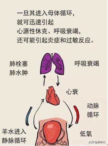刘强东姐姐难产,刘强东妹妹羊水栓塞朋友圈