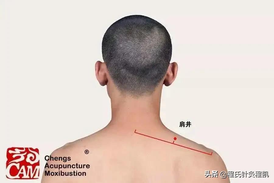 颈肩腰腿疼中药外敷特效方,外用特效治疗颈肩腰腿痛药酒配方