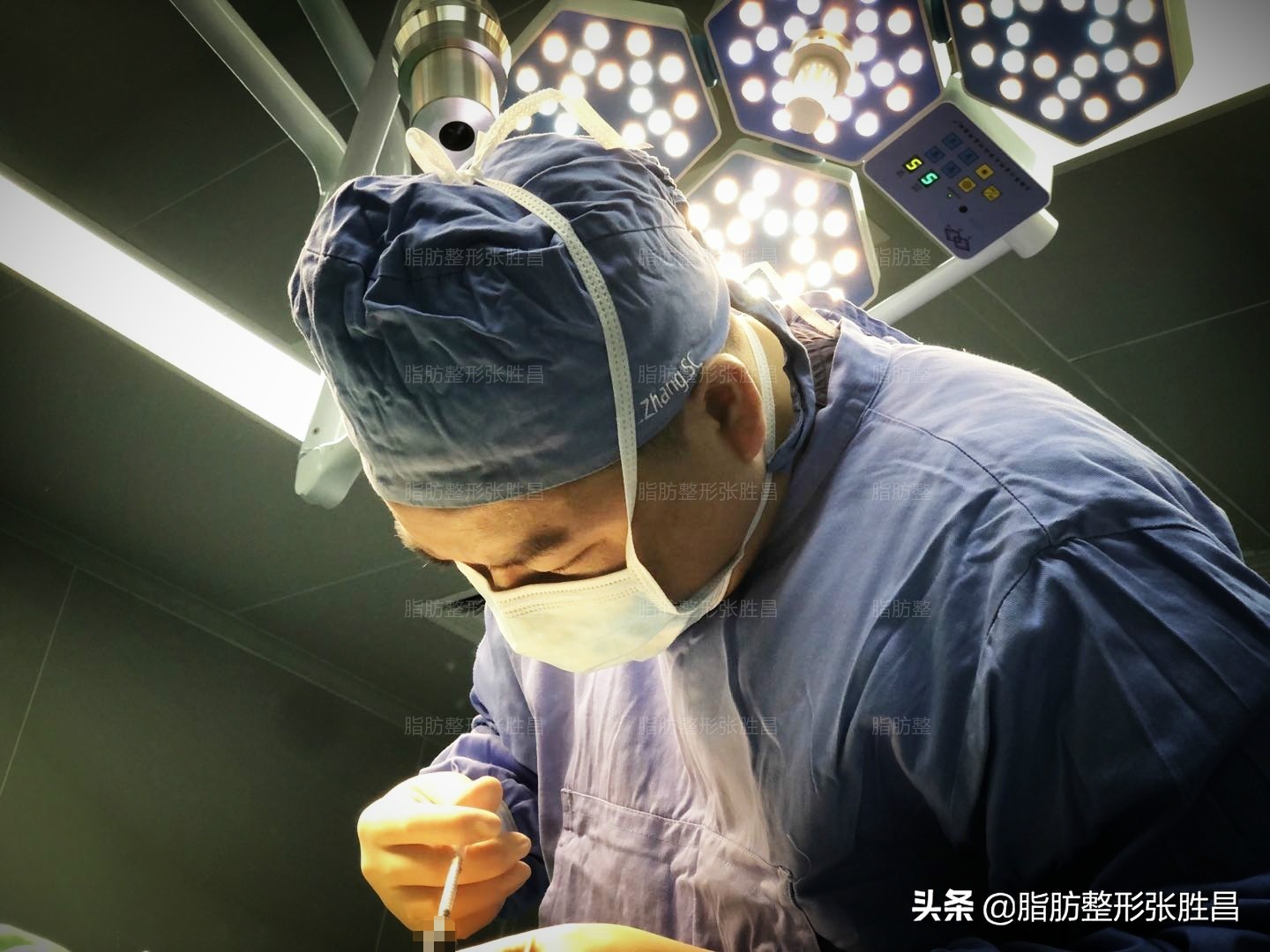 一次瘦脸针能维持多久,瘦脸针一次可以维持多久