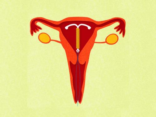 没有套套时,人类为了避孕有多「野」?