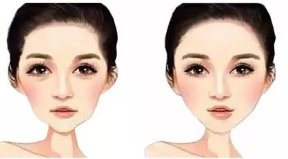 高颧骨脸颊凹妆容,高颧骨有办法改善吗