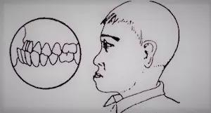 咱来侃侃“地包天”